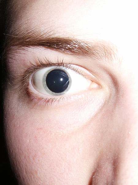 Pupil dilation